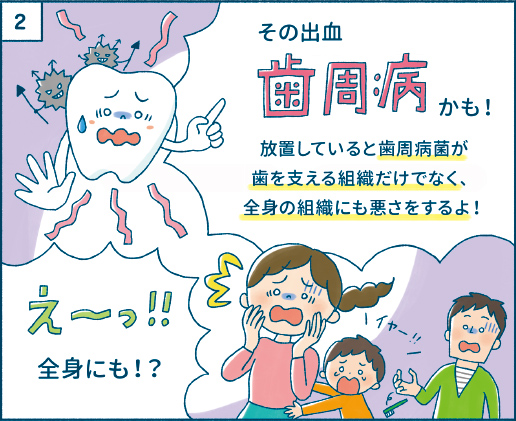 その出血、歯周病かも!放置していると歯周病菌が歯を支える組織だけでなく、全身の組織にも悪さをするよ!