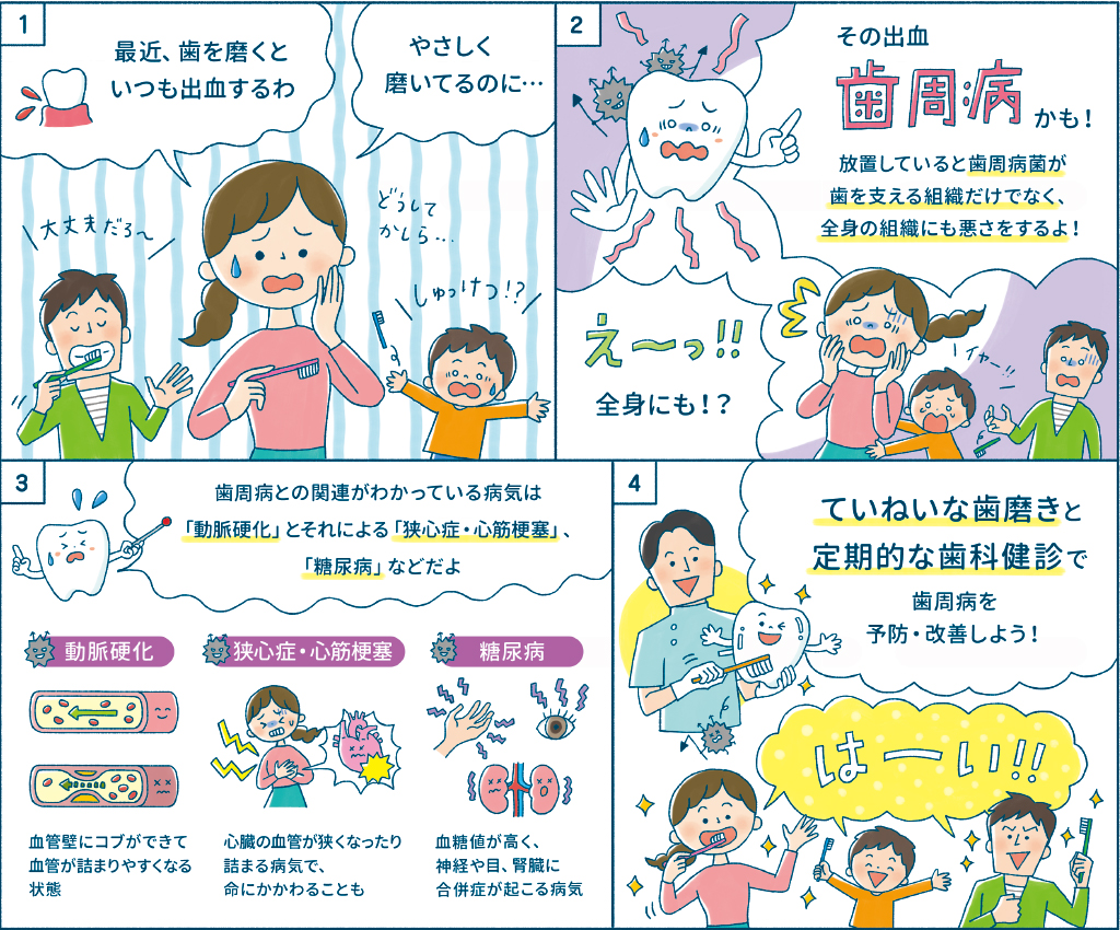 歯周病になると出血しやすくなる仕組みと、動脈硬化・狭心症・心筋梗塞・糖尿病など全身の病気とのかかわり、ていねいな歯磨きと定期的な歯科健診による予防・改善の漫画