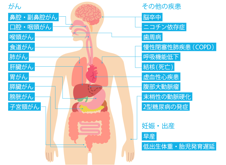 たばこを吸っている本人がなりやすい病気。がん:鼻腔・副鼻腔がん、口腔・咽頭がん、喉頭がん、食道がん、肺がん、肝臓がん、胃がん、膵臓がん、膀胱がん、子宮頸がん。その他の疾患:脳卒中、ニコチン依存症、歯周病、慢性閉塞性肺疾患(COPD)、呼吸機能低下、結核(死亡)、虚血性心疾患、腹部大動脈瘤、末梢性の動脈硬化、2型糖尿病の発症。妊娠・出産:早産、低出生体重・胎児発育遅延